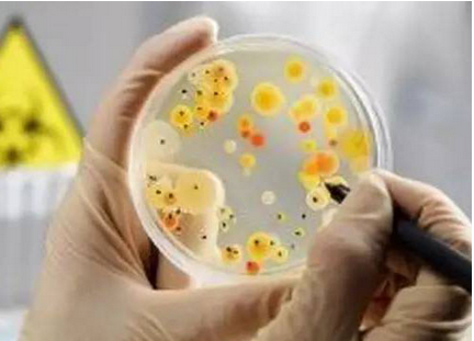 细菌微生物检测方法有哪几种